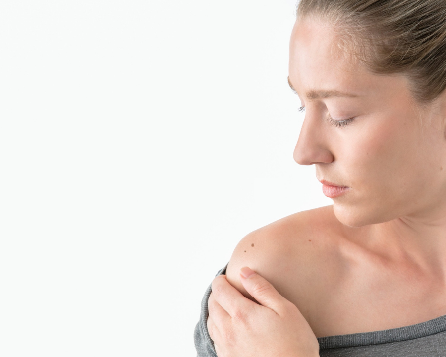Photo of woman inspecting mole on shoulder.