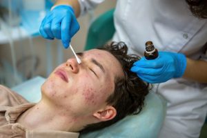 Best Acne Treatments in Canyon, TX